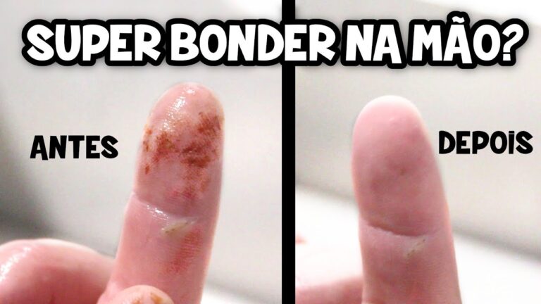 Dicas Eficazes para Remover Super Cola da Pele